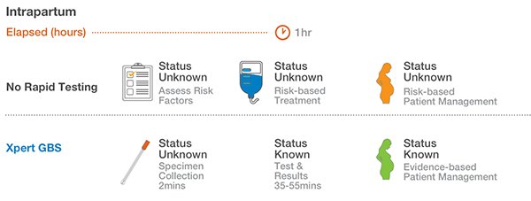 Cepheid Group B Strep Gbs Intrapartum Molecular Test Xpert Gbs